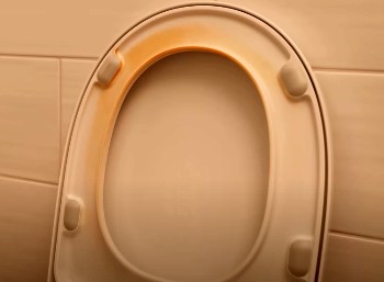dirt on the toilet seat
