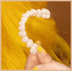 TruSmile Veneers