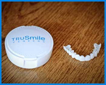 TruSmile Veneers