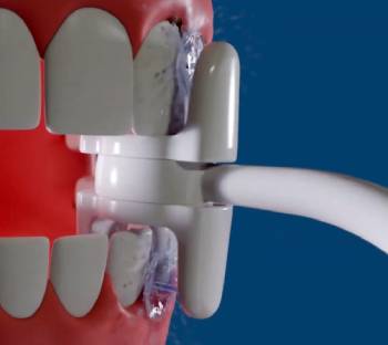 miracle smile magic flosser